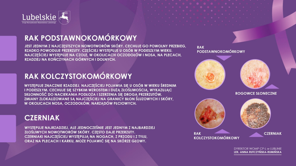 Program profilaktyki raka skóry dla mieszkańców województwa lubelskiego