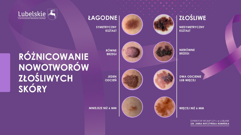 Program profilaktyki raka skóry dla mieszkańców województwa lubelskiego