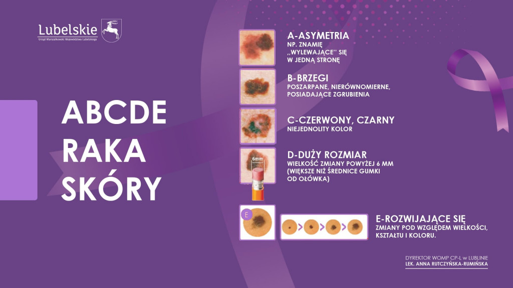 Program profilaktyki raka skóry dla mieszkańców województwa lubelskiego