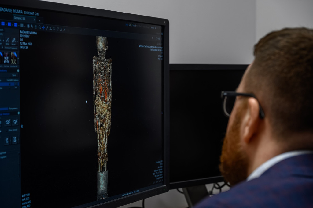 Egipska mumia pod lupą radiologów z Lublina