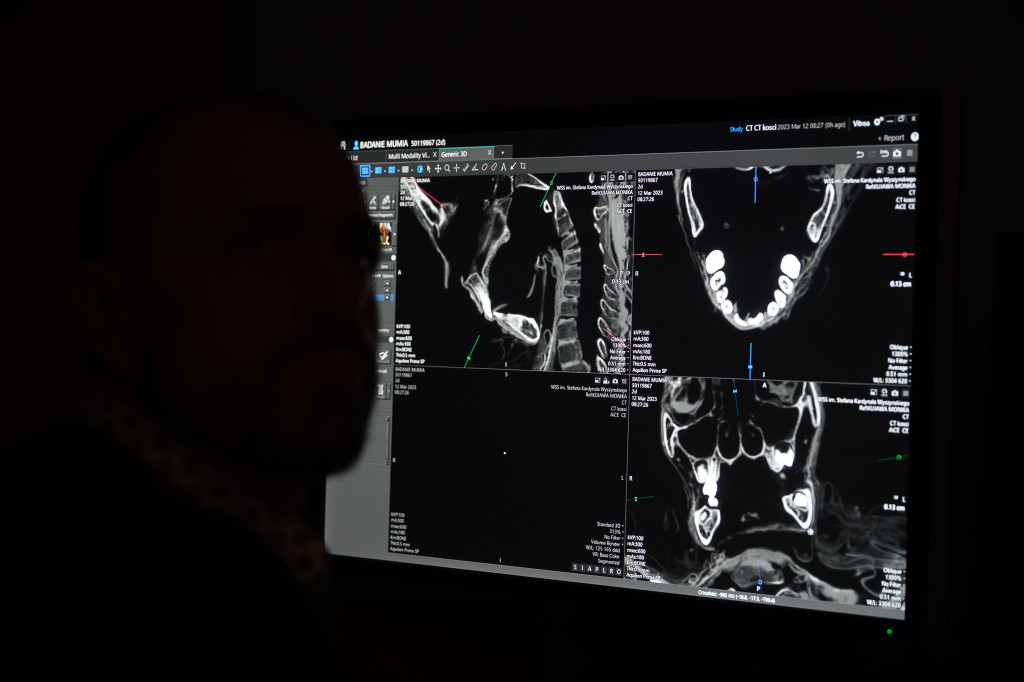 Egipska mumia pod lupą radiologów z Lublina