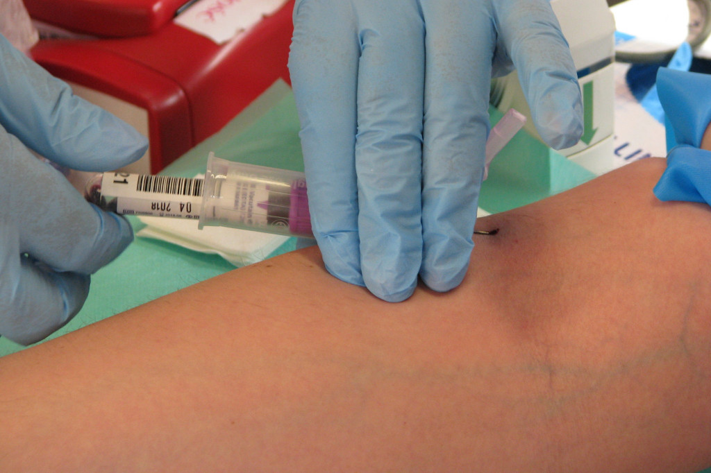 Zamość: Krwawy dzień w 