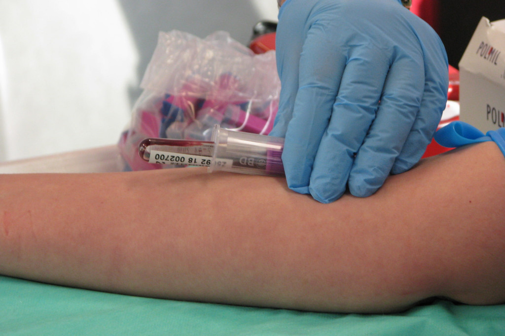 Zamość: Krwawy dzień w 