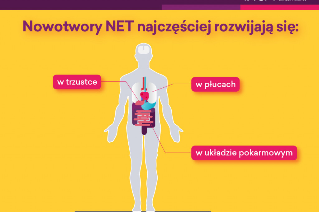 Światowy Dzień Nowotworów Neuroendokrynnych