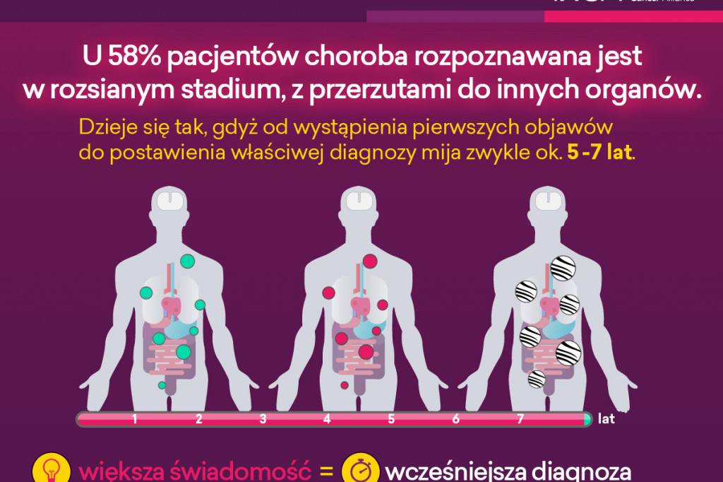 Światowy Dzień Nowotworów Neuroendokrynnych