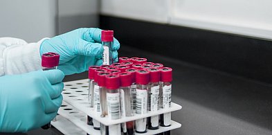 28 maja Światowy Dzień Walki z Nowotworami Krwi-364172